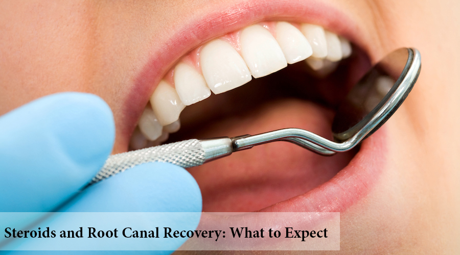 steroids after root canal